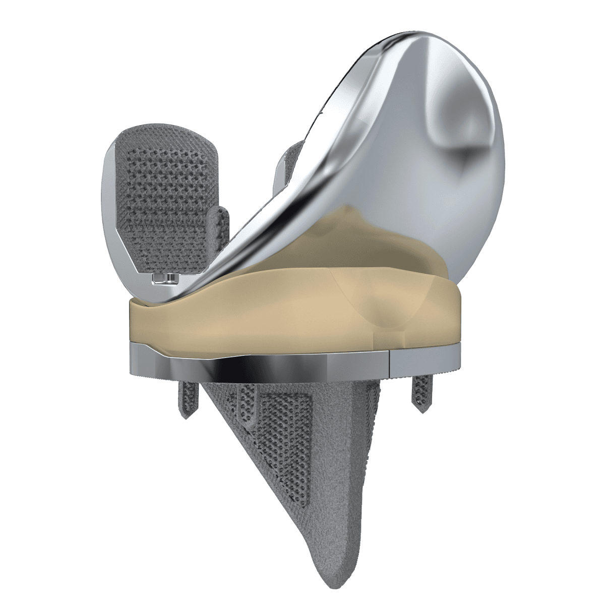 CONCOR – Uncemented Medial Pivot Knee